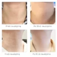 Arocell Super Neck Cream intensyvus kremas kaklo odai, 80 g4