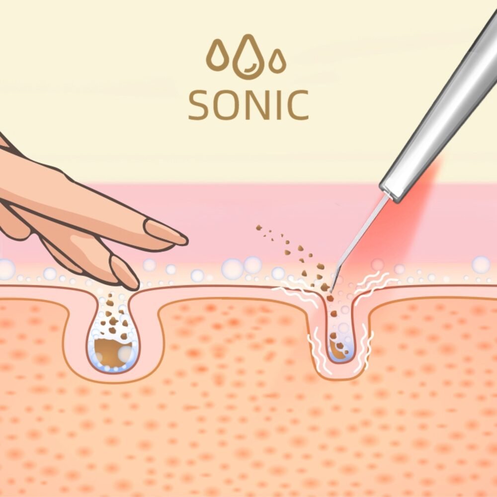 LUMINEO 5in1 kavitacijos pilingo rinkinys MEGA drėkinimui (tonikas, serumas, kremas)3