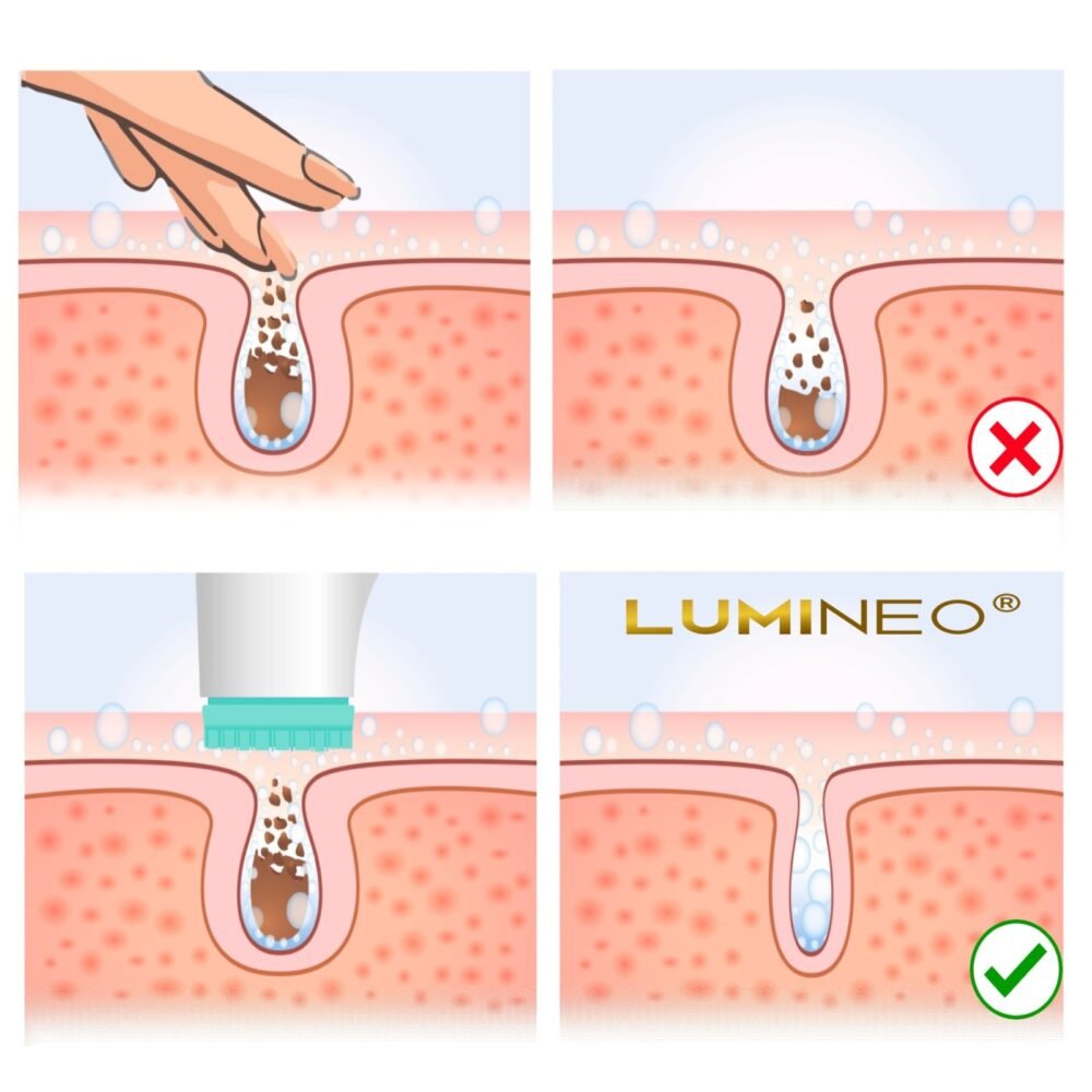 LUMINEO PRO turkio spalvos veido šepetėlis su 4 antgaliais + gelis probleminei odai12