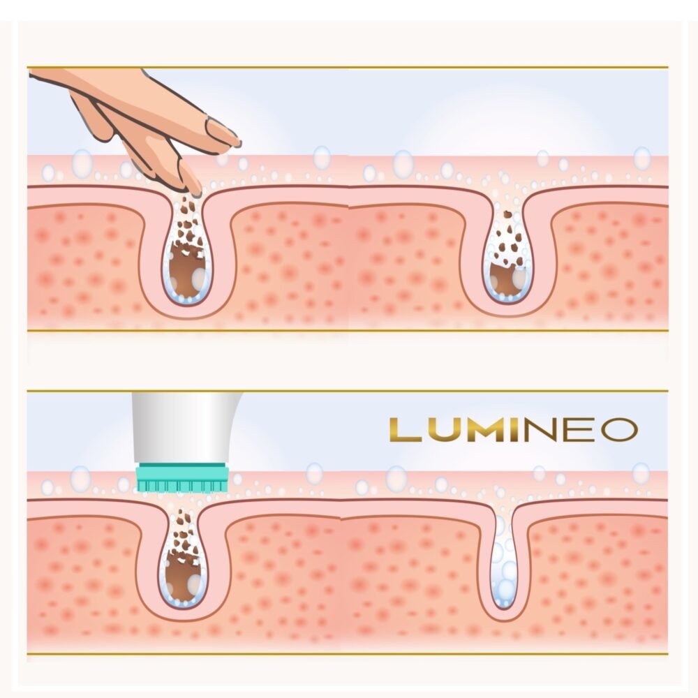 LUMINEO PRO veido valymo šepetėlis + gelis visų tipų odai14